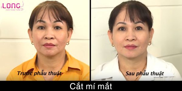 cat-mat-2-mi-co-gay-dangerous-hiem-gi-khong