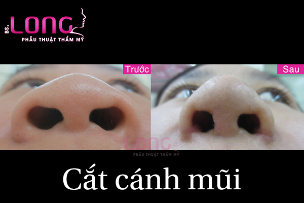 cat-canh-mui-bao-lau-thi-lanh-han-1