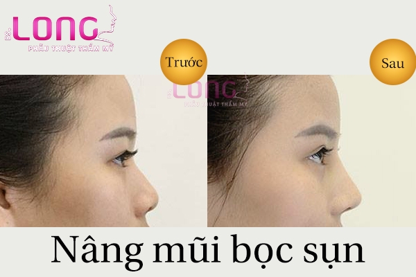 Nang-mui-boc-sun-tu-than-co-de-repeat-seo-khong-1