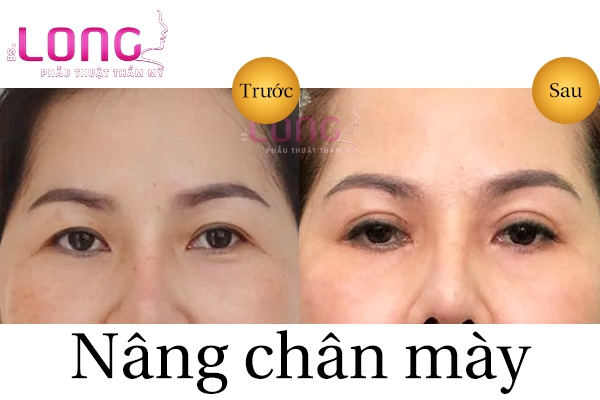 nang-chan-may-gia-bao-nhieu-tien-hien-nay-2