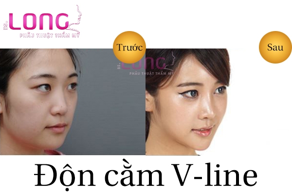 don-cam-vline-co-seo-khong-2