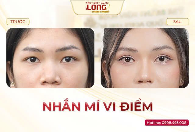 nhan-mi-bacsilong