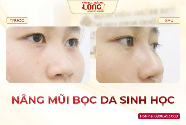 nang-mui-boc-da-sinh-hoc_cho-khach