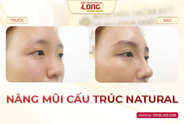 nang-mui-cau-truc_cho-khach