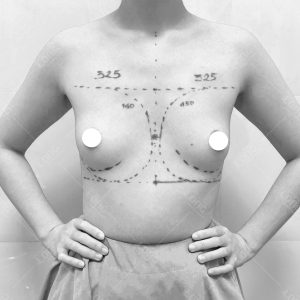 khach-hang-nang-nguc-noi-soi