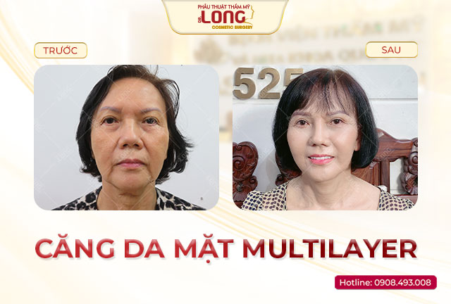 khach-hang-cang-da-mat
