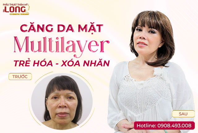 cang-da-mat-phau-thuat
