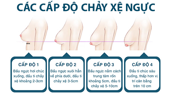 chay-xe-nguc