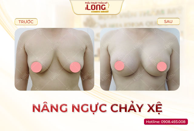 nang-nguc-chay-xe