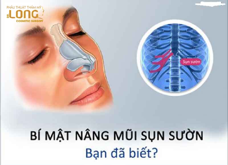 Nâng mũi sụn sườn sử dụng sụn từ cơ thể để giảm thiểu được tối đa nguy cơ biến chứng