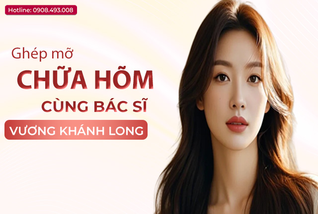 ghep-mo-chua-hom