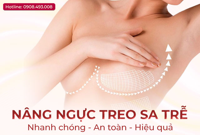 nang-nguc-treo-sa-tre