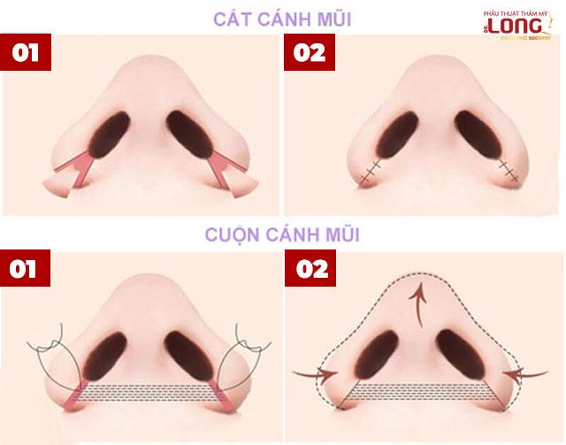 Một số phương pháp thu cánh mũi phổ biến được ưa chuộng nhất hiện nay