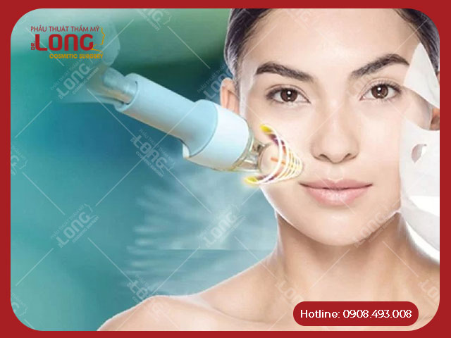 Căng da mặt bằng tia Laser là phương pháp thẩm mỹ hiện đại được tin dùng