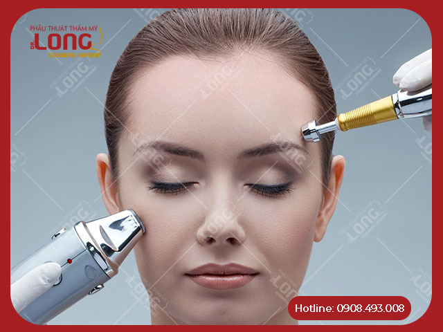 Công nghệ Laser bóc tách giúp xóa sổ nếp nhăn hiệu quả