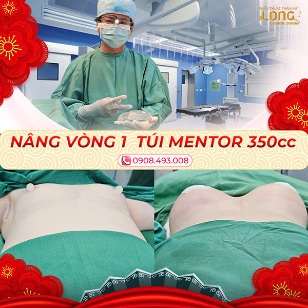 bac-si-nang-nguc-noi-soi