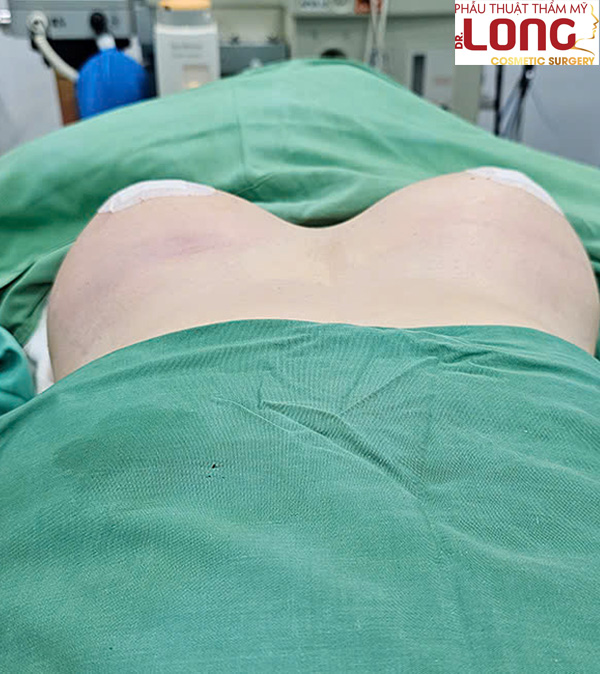 nang-nguc-noi-soi-bacsilong