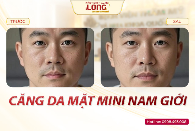 cang-da-mat-mini-nam-gioi