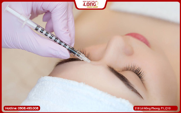 chuan-bi-gi-truoc-khi-cang-da-tran