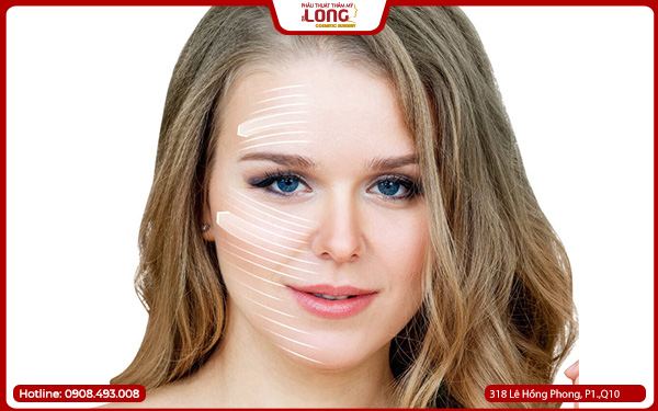 luu-y-cang-da-mat-phau-thuat