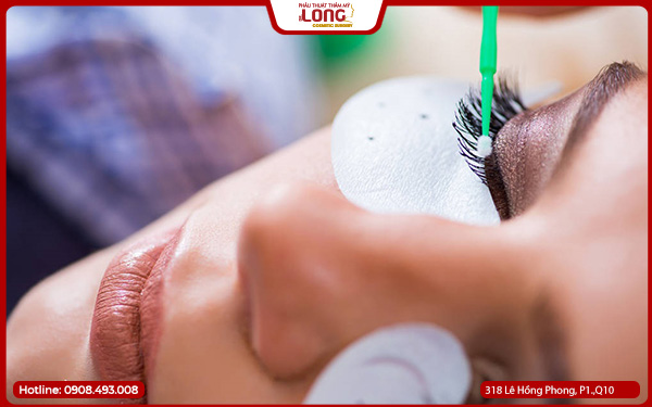 Nhấn mí đẹp ở tphcm