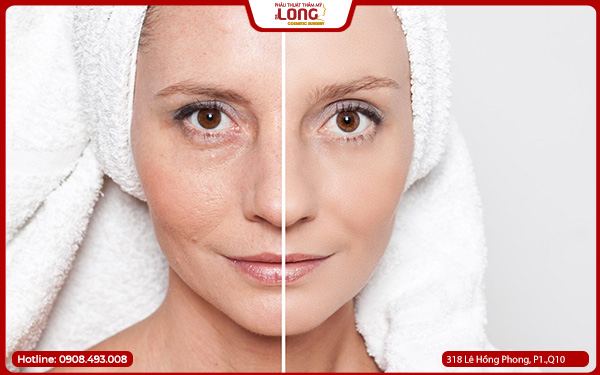 doi-tuong-phu-hop-cang-da-mat-phau-thuat