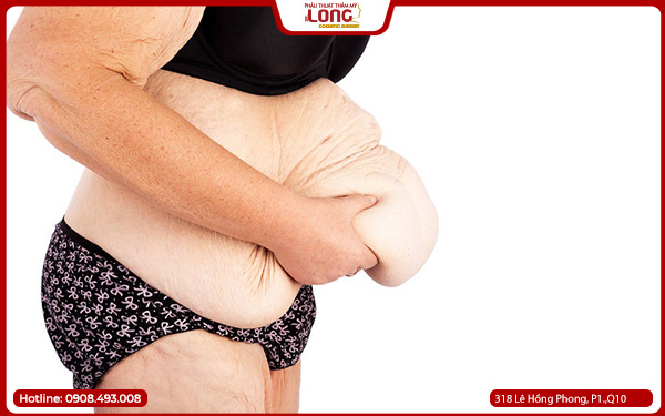 cang-da-bung-cho-nguoi-trung-nien