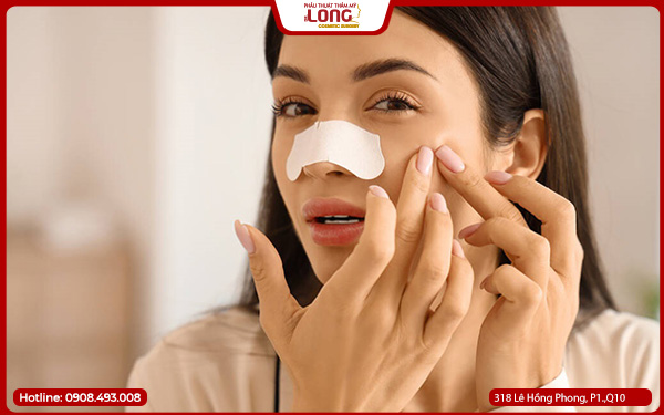 Cắt cánh mũi bao lâu thì lành