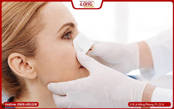 chi-phi-nang-mui-boc-megaderm