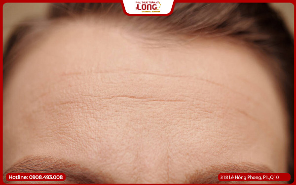 dau-hieu-cang-da-tran-bi-loi