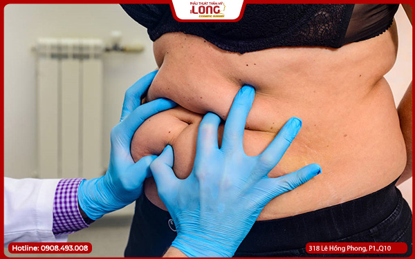 khi-nao-cang-da-bung