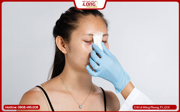 nang-mui-boc-megaderm-bao-nhieu-tien