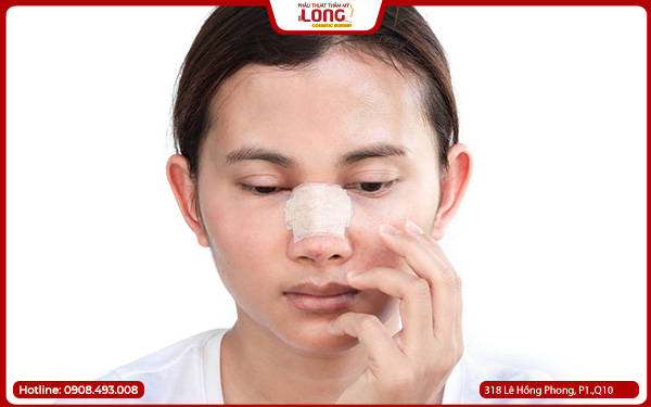 nang-mui-boc-megaderm-o-dau-dep