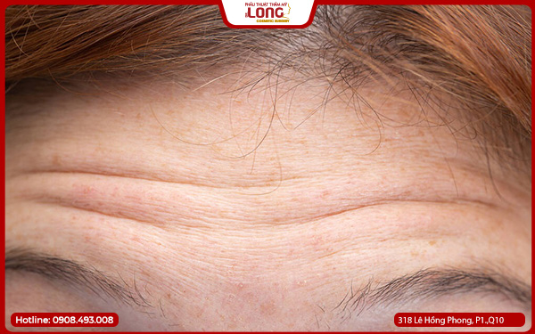 nhung-dieu-can-tranh-sau-khi-cang-da-tran