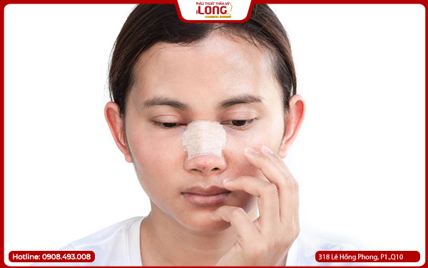 phau-thuat-thu-gon-canh-mui