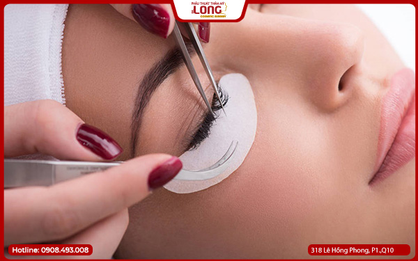 cắt mí bao lâu lành