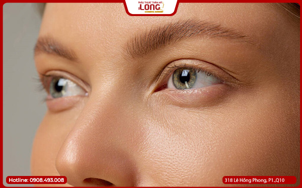 cham-soc-sau-khi-mo-rong-goc-mat