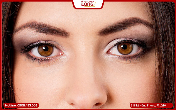 chi-phi-mo-rong-goc-mat