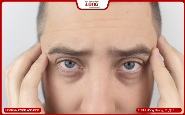 lay-bong-mo-mat-cho-nam-gioi