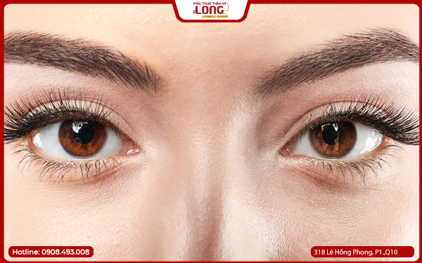 lay-bong-mo-mat-o-dau-tot