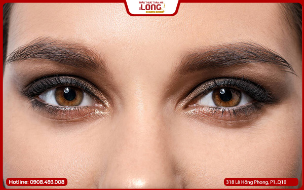 Mở rộng góc mắt bị sưng bao lâu