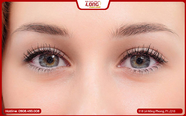 mo-rong-goc-mat-co-de-lai-seo-khong