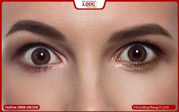 mo-tong-goc-mat-la-gi