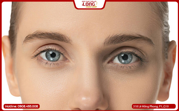 mo-rong-goc-mat-ngoai