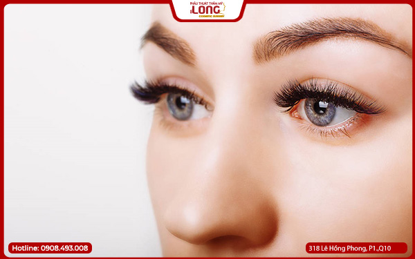 mo-rong-goc-mat-o-dau-tot