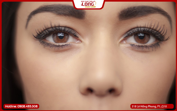 mo-rong-goc-mat-tai-tphcm