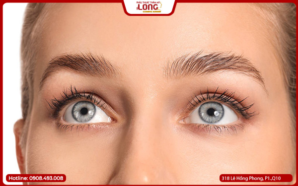 mo-rong-goc-mat-trong