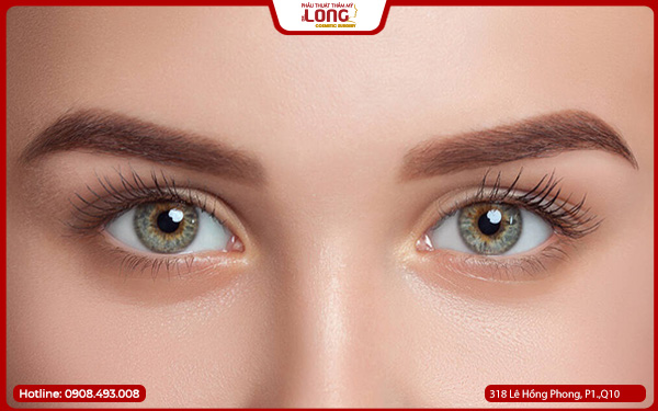 quy-trinh-mo-rong-goc-mat