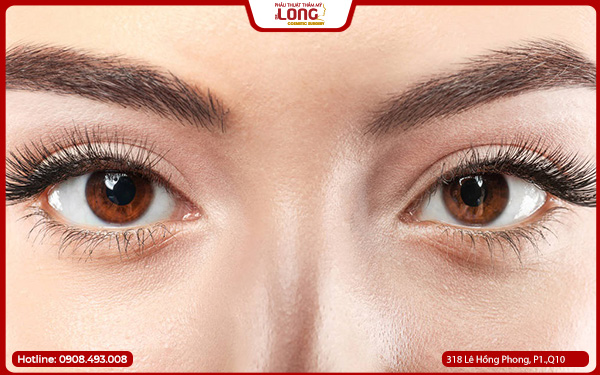 review-mo-rong-goc-mat