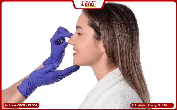 thu-gon-canh-mui-mat-bao-lau-hoi-phuc